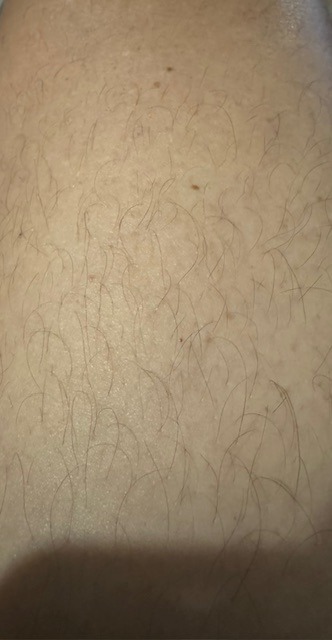 Gutemberg - Root - Lucerne | Rencontre Mature